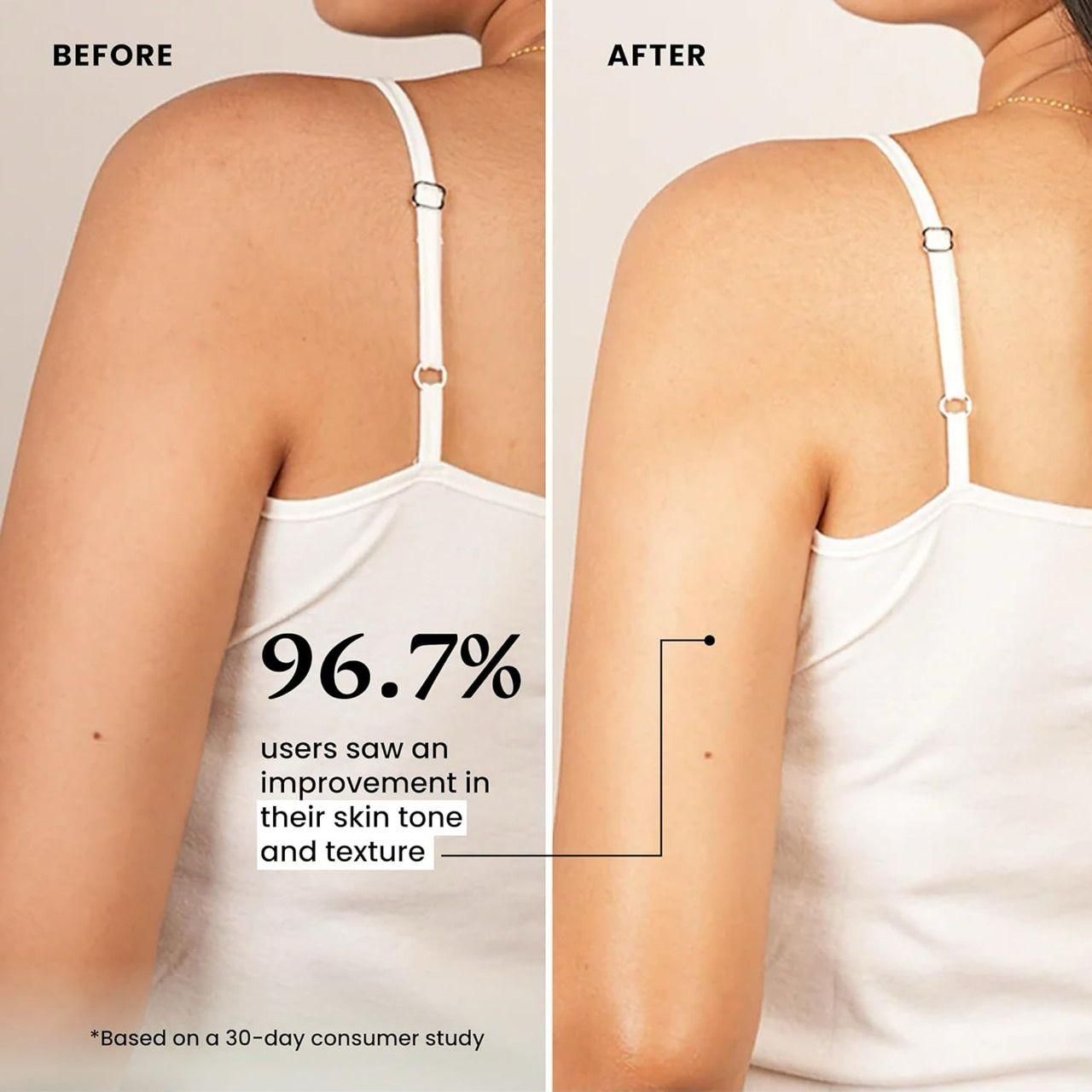 Kem Cot Thai Cream - Fectorect.com