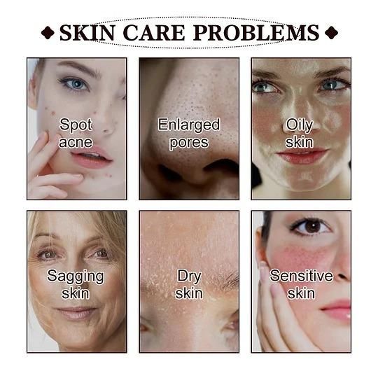 Black Tea Face Mask 100g Pack of 1 - Fectorect.com