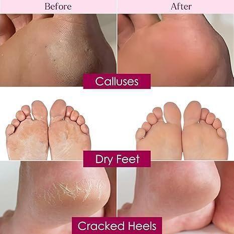 Exfoliating Foot Mask