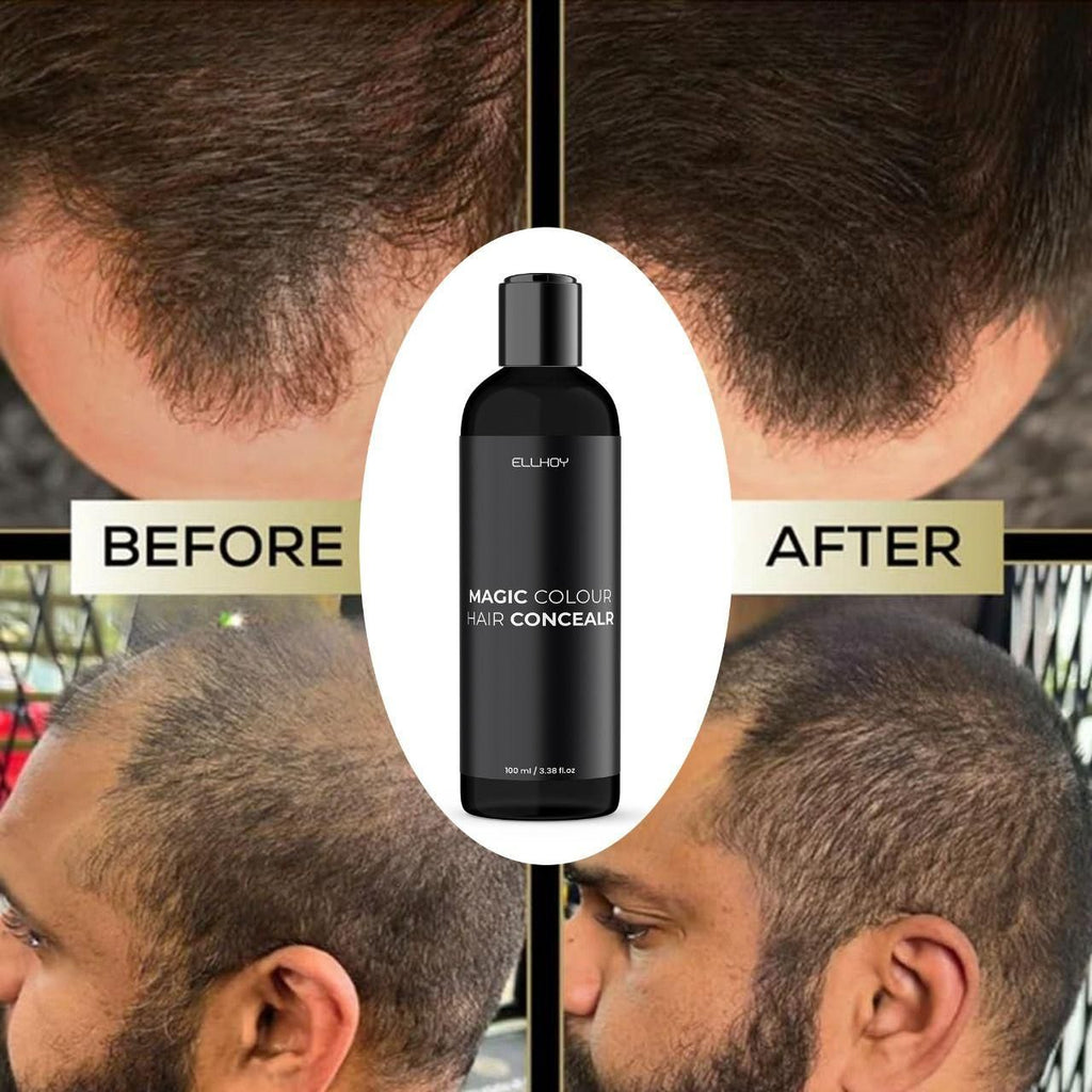 ELLHOY Magic Colour Hair Concealer Spray 100ML (Pack of 2) - Fectorect.com