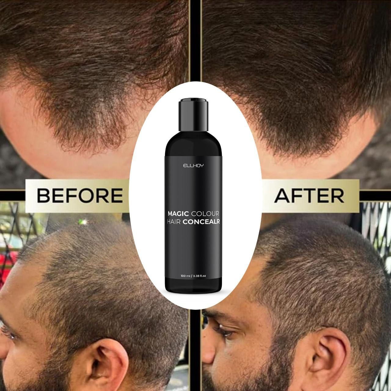 ELLHOY Magic Colour Hair Concealer Spray 100ML (Pack of 2) - Fectorect.com